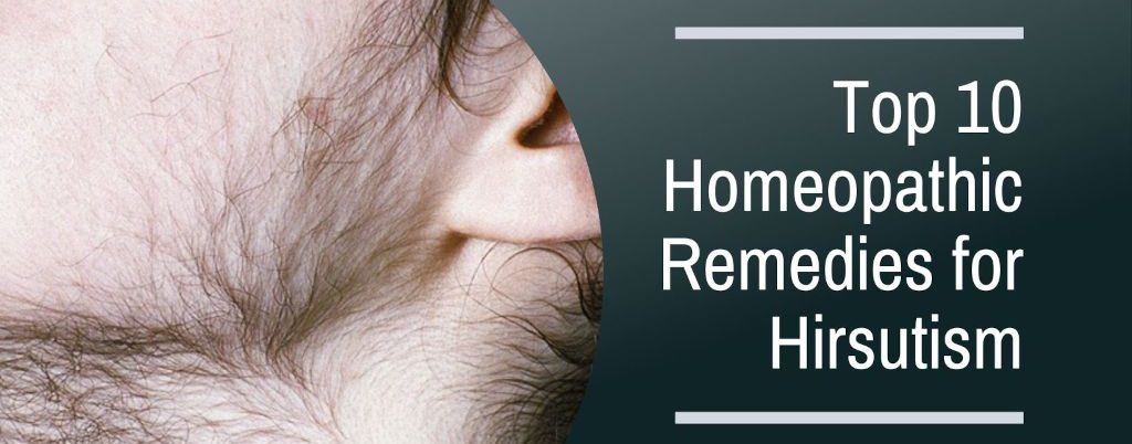 Top 10 Homeopathic Remedies for Hirsutism